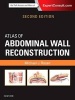 Atlas of Abdominal Wall Reconstruction (Hardcover, 2nd Revised edition) - Michael J Rosen Photo