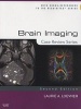 Brain Imaging (Hardcover, 2nd Revised edition) - Laurie A Loevner Photo