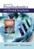 Journal of Prosthodontics on Dental Implants (Hardcover) - Stephen M Parel Photo